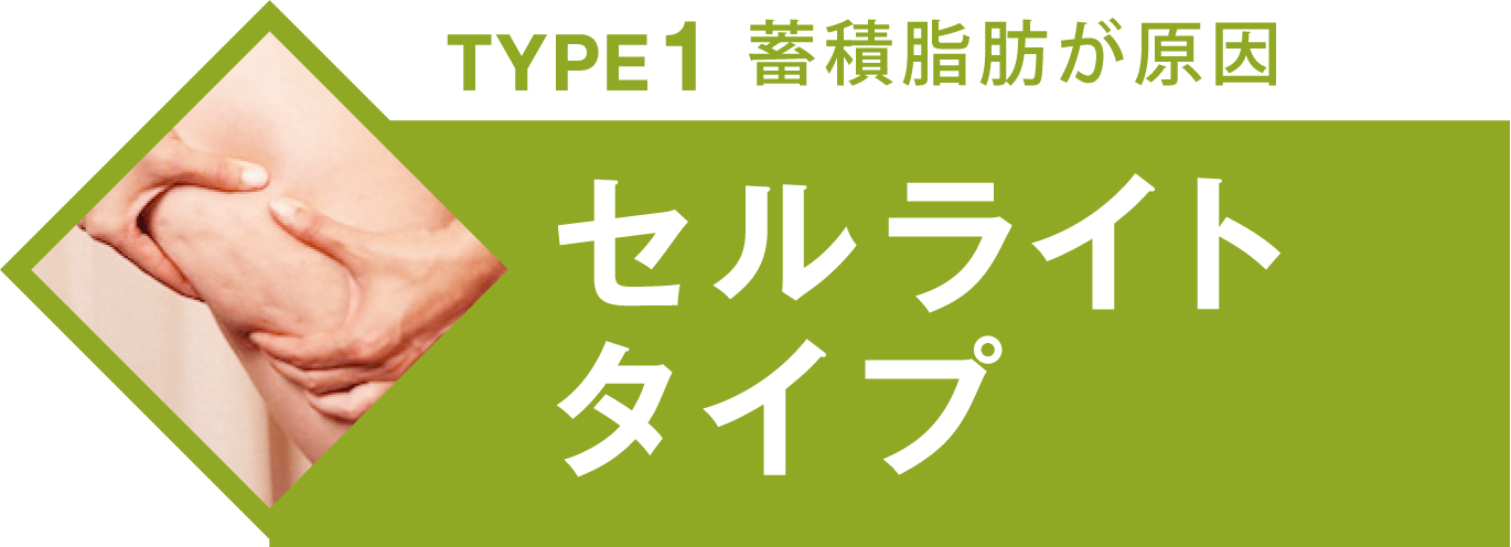 TYPE1 蓄積脂肪が原因 セルライトタイプ